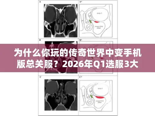 为什么你玩的传奇世界中变手机版总关服？2026年Q1选服3大命门解析