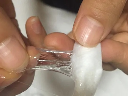 做完之后下面流液体怎么回事