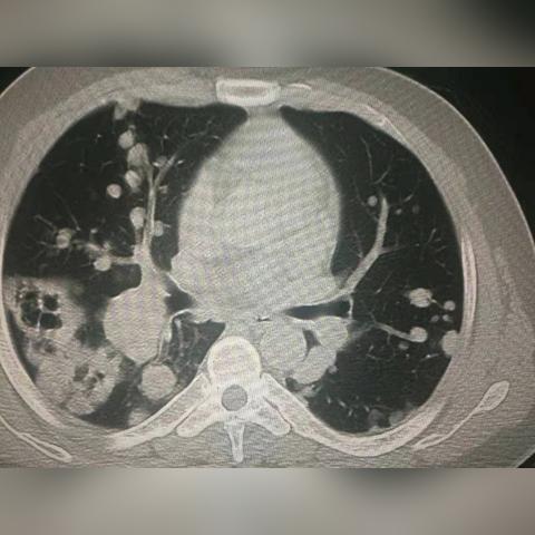 《空洞骑士》丝之歌纪元终章攻略:快速找到蘑菇先生位置技巧分享 《空洞骑士》丝之歌纪元终章攻略:快速找到蘑菇先生位置技巧分享