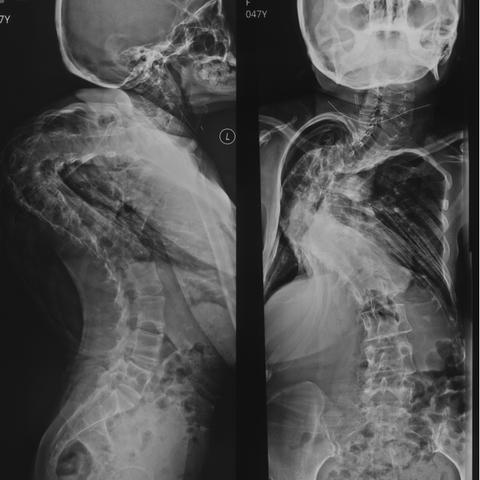 《空洞骑士丝之歌》毒轮椅攻略：解锁隐藏技巧，轻松通关秘籍！
