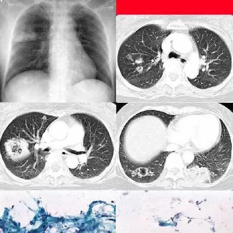 《空洞骑士》速刷念珠攻略：开局高效刷珠子技巧揭秘