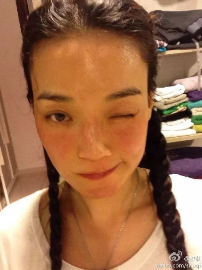舒淇息影真相曝光：敏感肌肤成隐退主因，护肤新趋势引关注