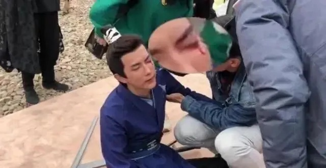 演员拍戏意外受伤，对手未摘饰品成隐患揭秘