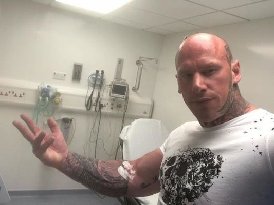 凡士林注射打造巨臂奇人，感染悲剧见证健身极限