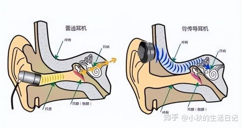 头晕不适者慎用，骨传导耳机专家提醒这三类人群不宜佩戴