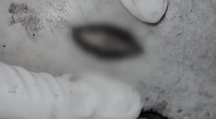 男子晾衣意外卡衣架窒息亡，法医称罕见程度超陨石撞击