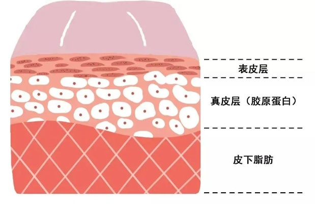 厚皮哪里多 厚皮哪里多