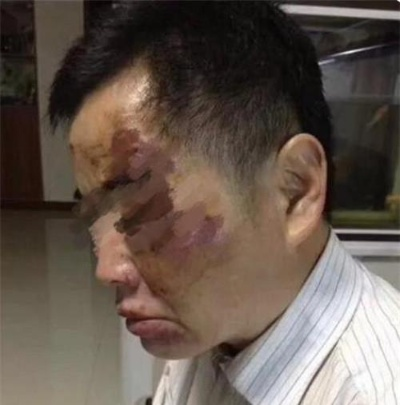 屠龙刀爆了,昆山砍人事件中宝马男跑回车内可能是想做什么