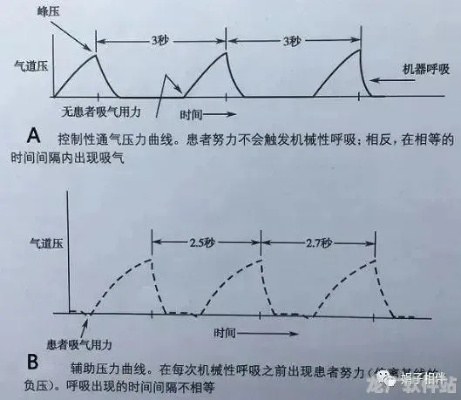 一、呼吸条管理,被90%玩家忽略的核心机制 一、呼吸条管理,被90%玩家忽略的核心机制
