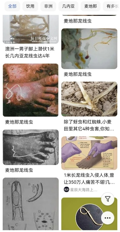 四川惊现数米长龙线虫？现场鉴定+防护全攻略2026最新