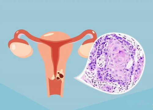 震惊！24岁女子扮15岁少女诱捕警察，公开处刑动态图曝光