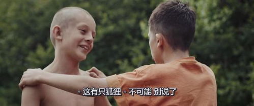 遭质疑眼神有问题,野兽先生,我最烦别人说我眼睛这事儿 遭质疑眼神有问题,野兽先生,我最烦别人说我眼睛这事儿