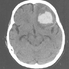 游戏开篇就提示小心癫痫，这种提醒对玩家来说真的不可或缺吗？