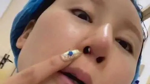 53岁女星隆胸悲剧，填充物破裂渗漏，美貌竟因此毁于一旦！