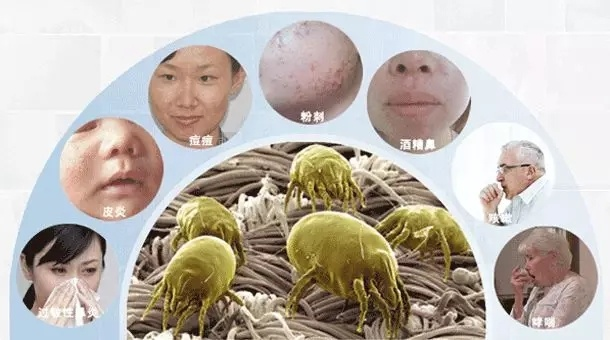 专家警告，上亿细菌尘螨藏床单，一周一洗别忽视！