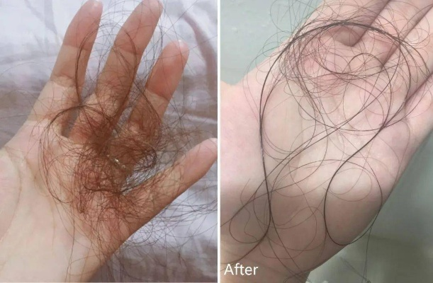 女子蓄发25年真实生存报告,从毛囊管理到社交博弈的完整实战手册 女子蓄发25年真实生存报告,从毛囊管理到社交博弈的完整实战手册