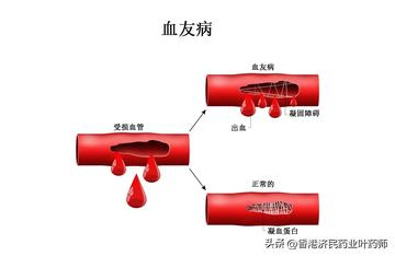 血之泛滥伤害打不上去?2026流血机制深度剖析与解决方案 血之泛滥伤害打不上去?2026流血机制深度剖析与解决方案