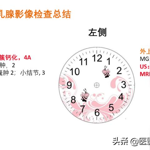 一、问题类型精准诊断，四象限定位法