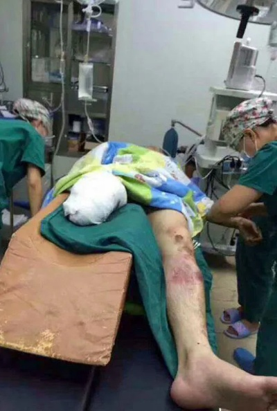 四肢截肢男子涉枪杀朋友后弃尸