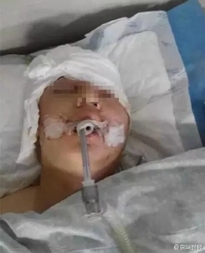 男大生挥霍骚扰后脑重启 电休克治疗改善行为