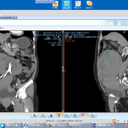男子CT检出子宫！涉事医院致歉：停职处理