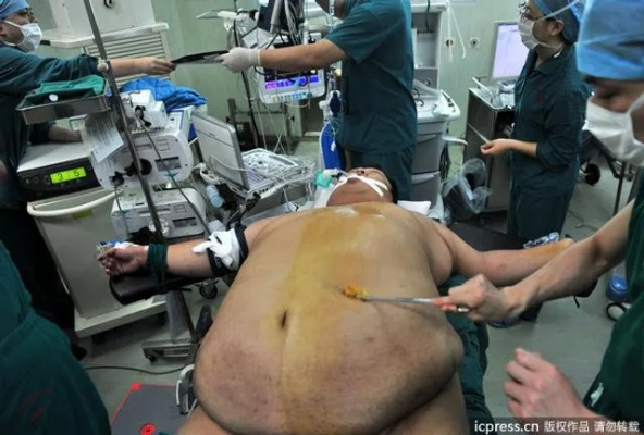 运动员退役后从146斤暴涨至523斤 手术切除75%胃 运动员退役后从146斤暴涨至523斤 手术切除75%胃